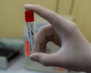 EU – Neue Debatte um PCR-Test-Kosten entfacht
