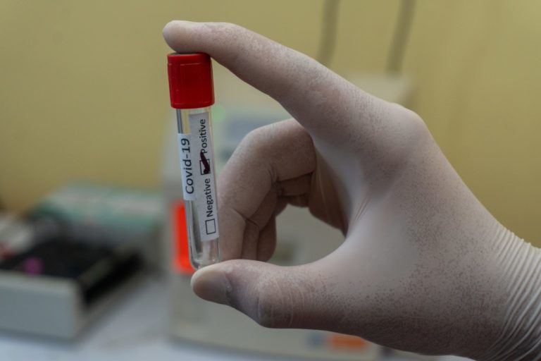 EU Neue Debatte um PCR Test Kosten entfacht